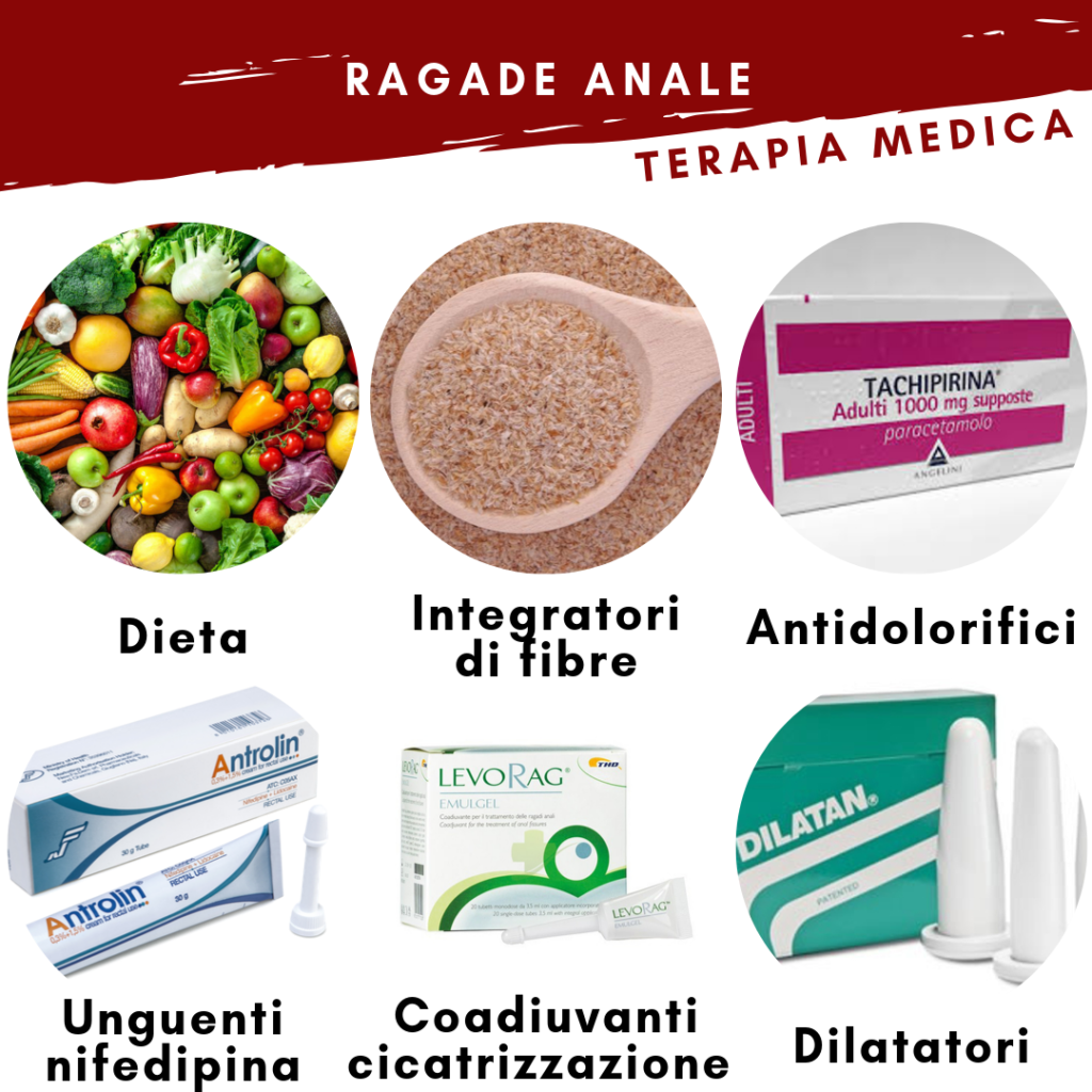 Terapie possibili nel trattamento della ragade anale