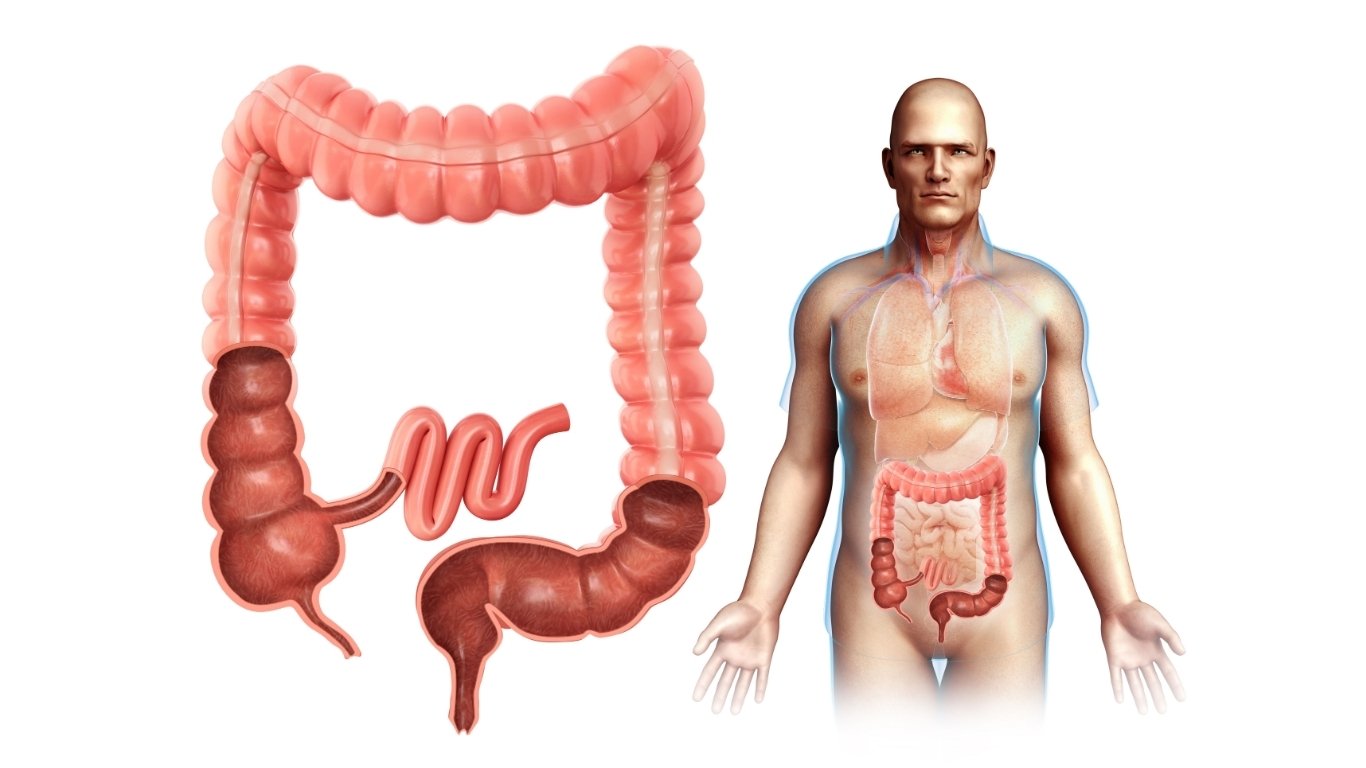 Adenocarcinoma colico| Dott. Paolo Boati | Chirurgo Generale a Milano