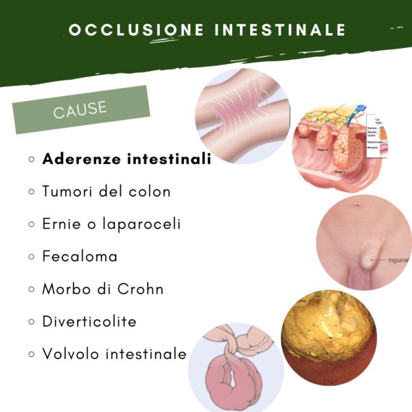 cause ostruzione intestinale